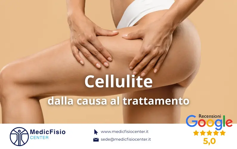 Cellulite: dalla causa al trattamento