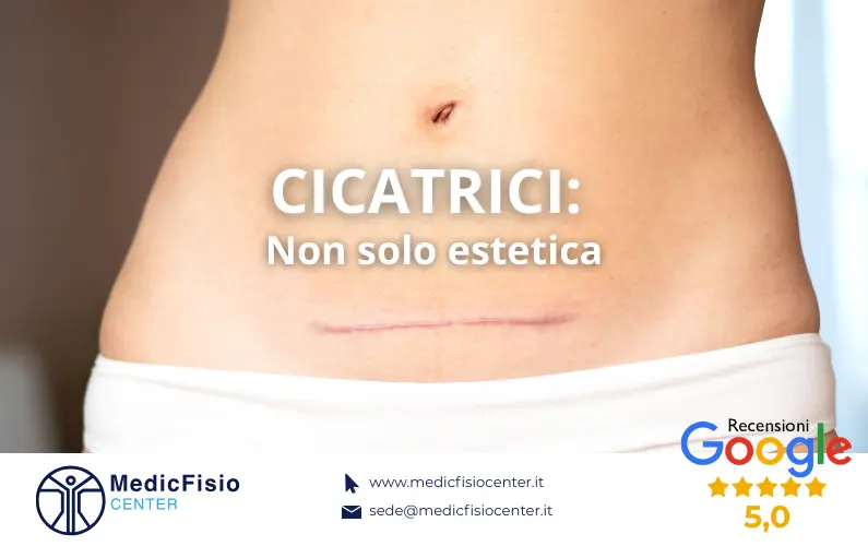 Cicatrici: un disagio estetico e non solo