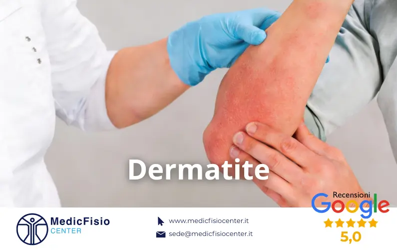 Dermatite: Come Riconoscerla, Rimedi e l'Importanza del Dermatologo
