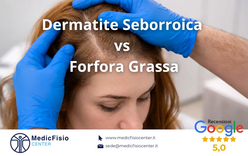Forfora Grassa o Dermatite Seborroica? Come Riconoscere la Differenza Prima che Peggiori