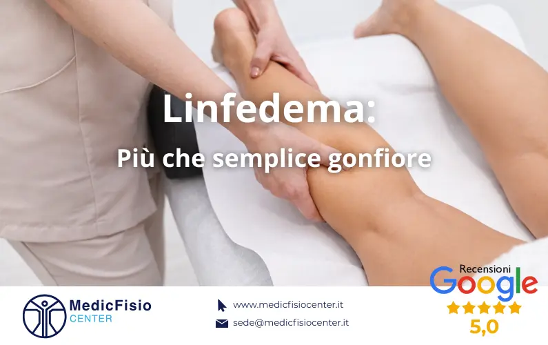 Linfedema: Più che semplice gonfiore