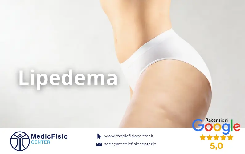 Lipedema: riconoscerlo e trattarlo